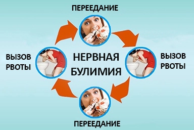Лечение булимии в Тулуне